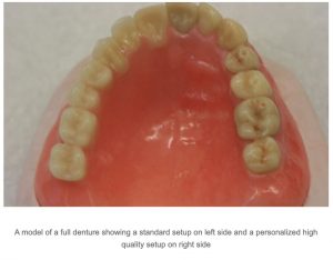 Lower Denture