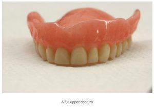 Denture Upper